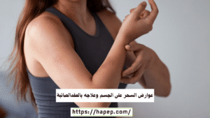 عوارض السحر على الجسم وعلاجه بالعقدالصائبة