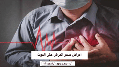 أعراض سحر المرض حتى الموت